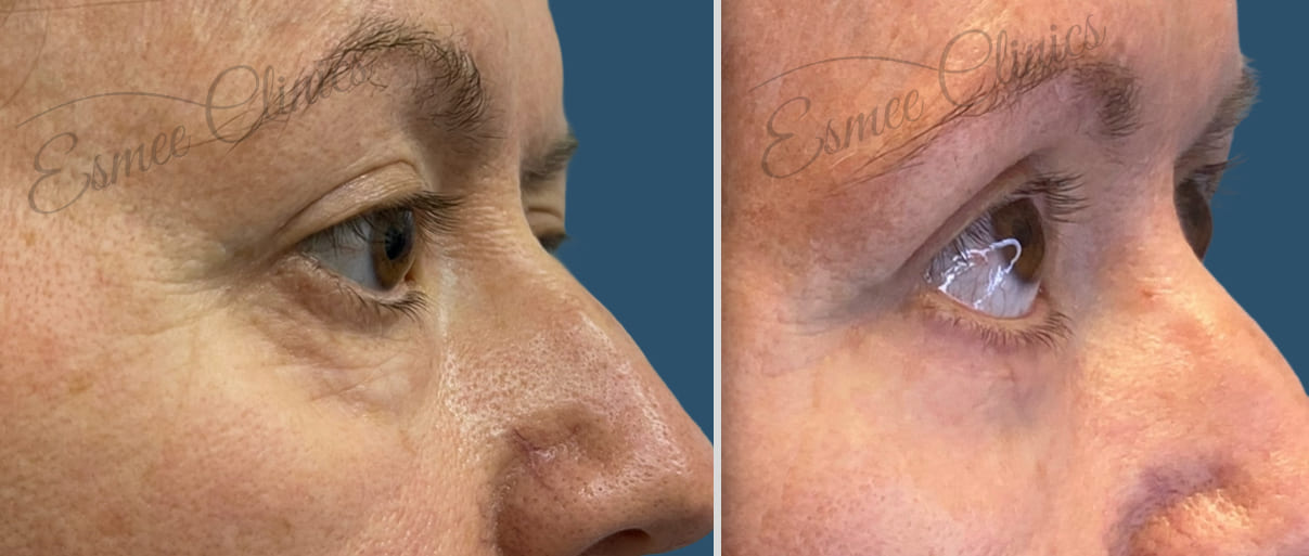 Before and After img